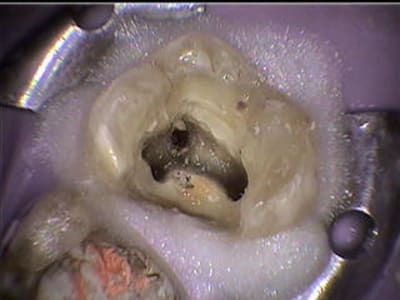 Pdt av fibre de verre rry6wg - Eugenol
