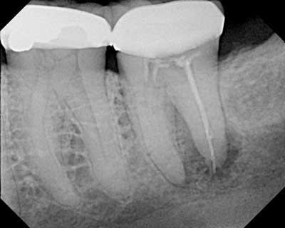 Pennwell.web.400 - Eugenol