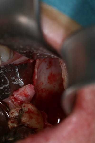 Per op3 ohs82a - Eugenol