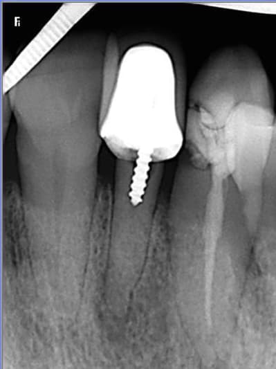 Pessoa zeqevt - Eugenol