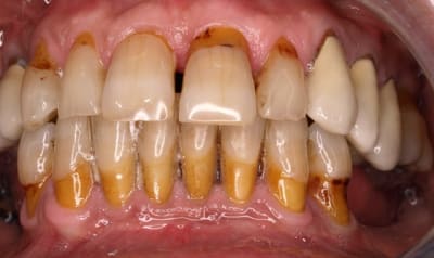 Petichou2 midxba - Eugenol