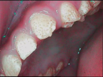 Petite2 m4dkqg - Eugenol