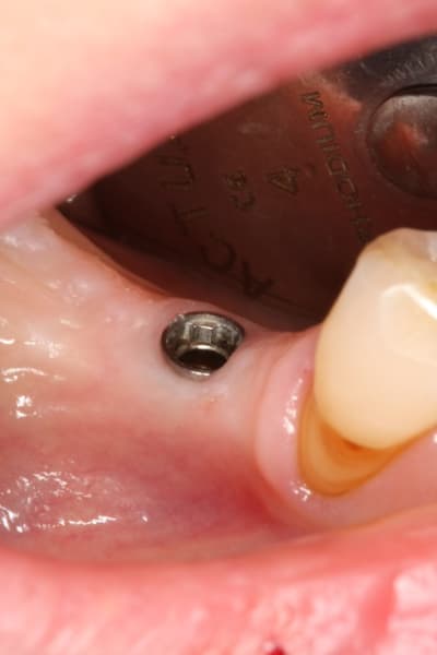 Photo3 zocjwj - Eugenol