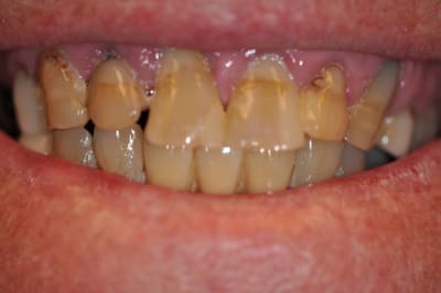 Photo 066 bqtjnz - Eugenol