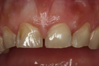 Photo 1 jwwl6e - Eugenol