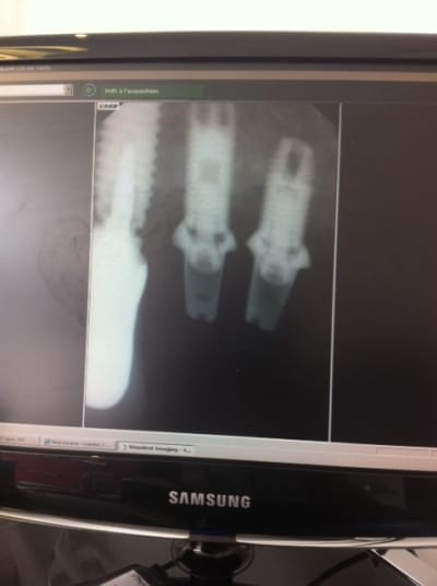 Photo 2 igdnpp - Eugenol