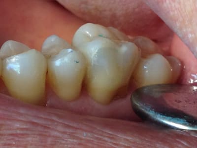 Photo 2 qm9b1a - Eugenol