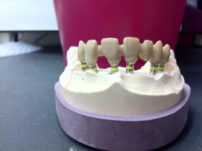 Photo 30 bxsldd - Eugenol