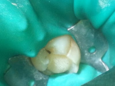 Photo 3 hq18dg - Eugenol