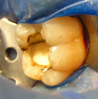 Photo 46 wdvapj - Eugenol