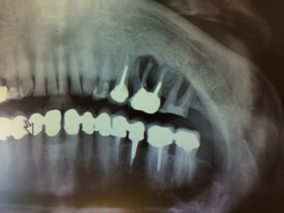 Photo x9zzxr - Eugenol
