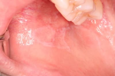 Pic1 bmtre1 - Eugenol