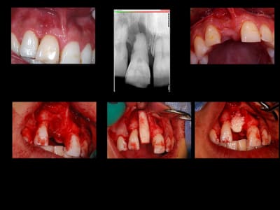 Planche1 nb4u3t - Eugenol