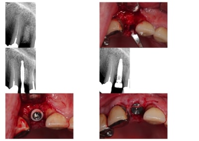 Planche2 ixoshw - Eugenol