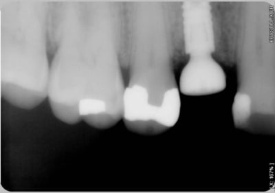 Platform switch mabia0 - Eugenol
