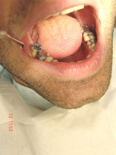 Points wgrlda - Eugenol