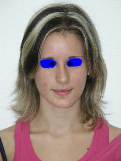 Portraitdeface qcnh4h - Eugenol