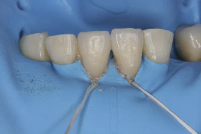 Pose1 r9rvmg - Eugenol