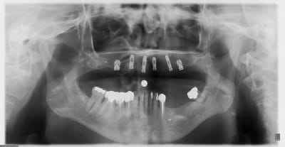 Pose aeu5bp - Eugenol
