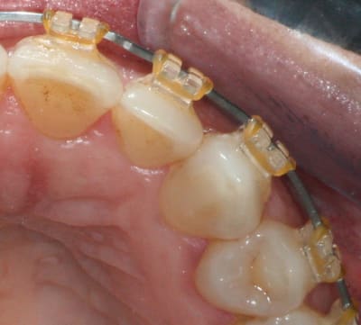 Pourhallboy i8xlxs - Eugenol