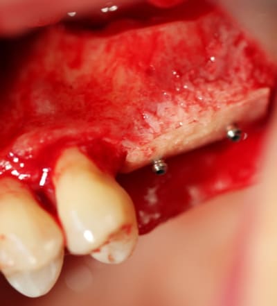 Pouy 017 gmyykf - Eugenol