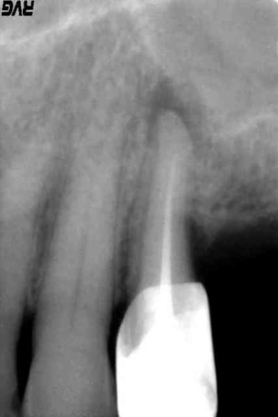Pr  op ztrpi5 - Eugenol
