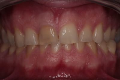 Pre op skpc88 - Eugenol