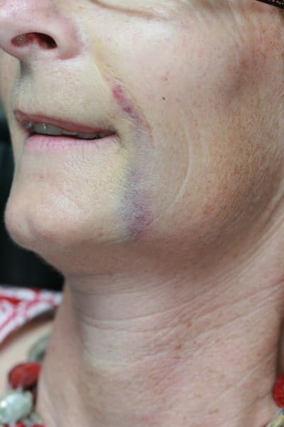 Profil plusb1 - Eugenol