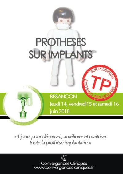 Prothèse sur implants grlh2c - Eugenol