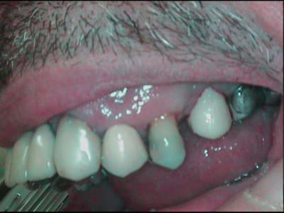 Provisoire hnxisy - Eugenol