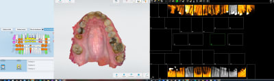 Ptt cam rxx cwjll0 - Eugenol