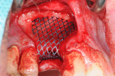 Pxqqtv25h7pwymck88js - Eugenol