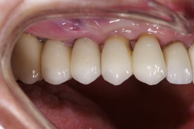 Q  6 novembre 2014 vtispk - Eugenol
