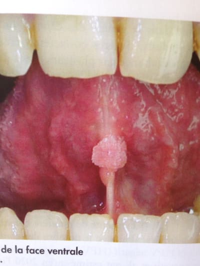 Qf1vmoxdyv8jbdq4n0iy - Eugenol