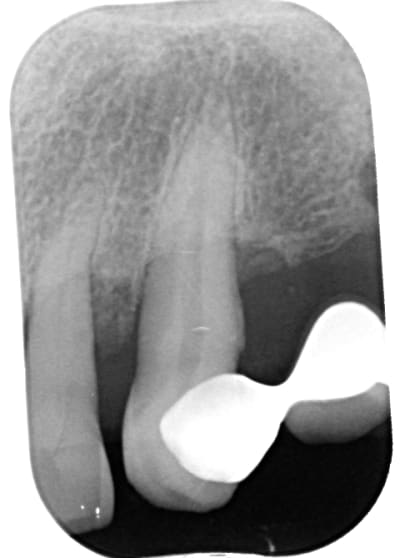 Qg836nz1jy66ypcsrufo - Eugenol