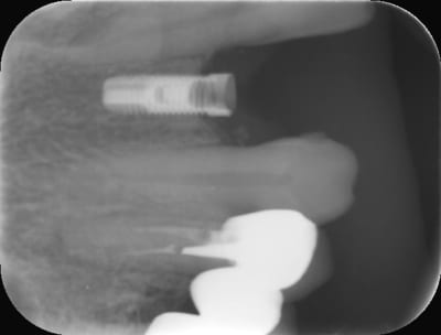 Qillbnmjihnee02oolyb - Eugenol