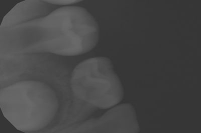 Qpeqh7hgqczz40vxlrno - Eugenol