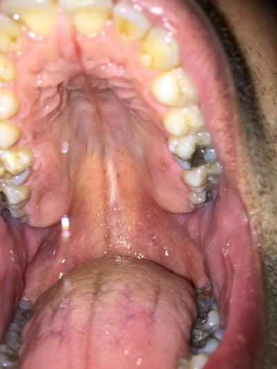 Qs53rtbkakio3swfn5qc - Eugenol