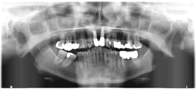 Quovjlurf5y3fscohkbl - Eugenol