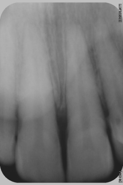 Radio2 ypv6ed - Eugenol