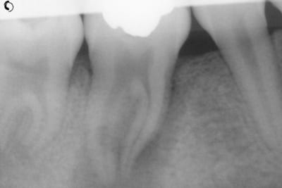 Radio 1 oynfuo - Eugenol