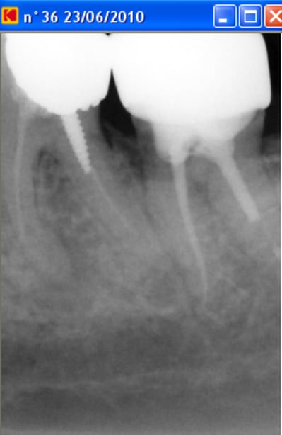 Radiopreop1 reyqas - Eugenol