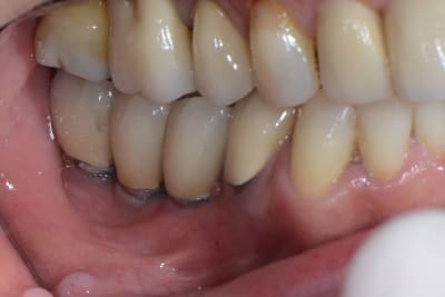 Rcvlimtndu0reo8oyx44 - Eugenol