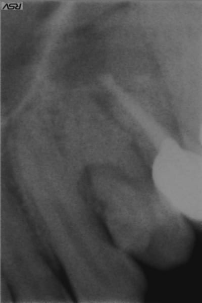 Regnane ugtcfg - Eugenol