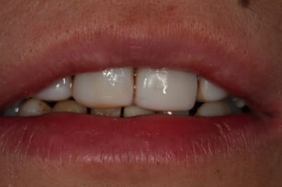 Repos uxh6x2 - Eugenol