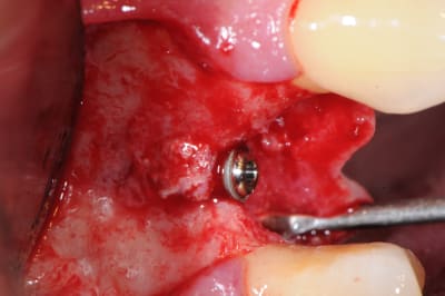 Rklh7woqcvxkpmraxhci - Eugenol