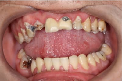 Rld hqgi8o - Eugenol
