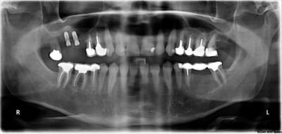 Ro1 xpvk7y - Eugenol