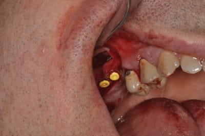 Ro2 opeywz - Eugenol