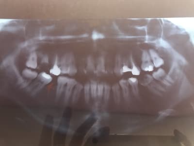 Ro4qi10zajxakp6mzp2w - Eugenol